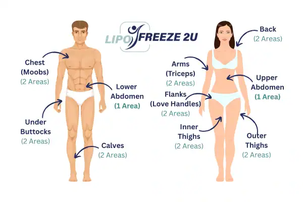 Areas you can have fat freezing treatment Kingston upon Thames