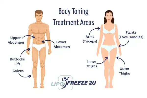 Graphic showing where you can have Body toning Treatment Kingston upon Thames on your body