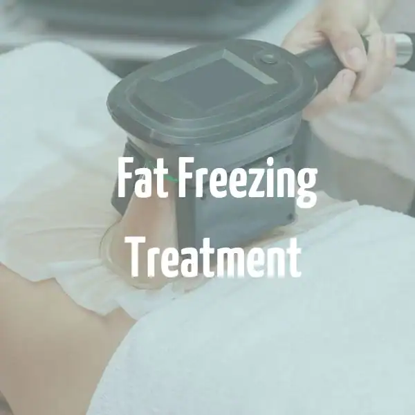 fat freezing treatment Kingston upon Thames