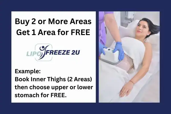 fat freezing prices Kingston upon Thames