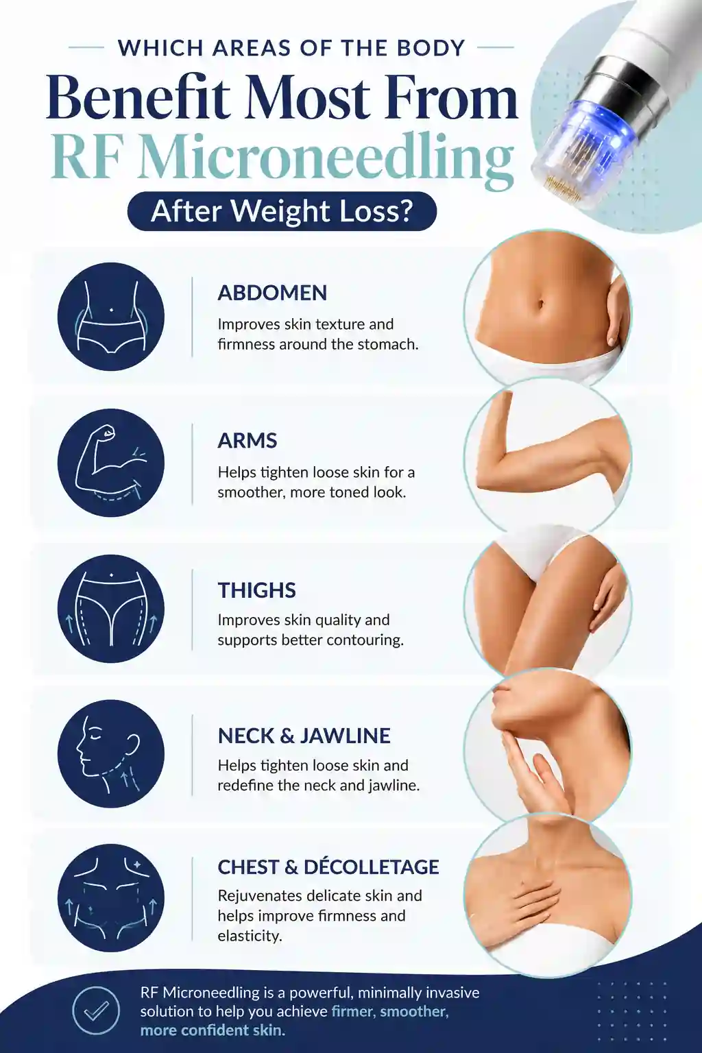 Which Areas of the Body Benefit Most From RF Microneedling After Weight Loss Kingston upon Thames