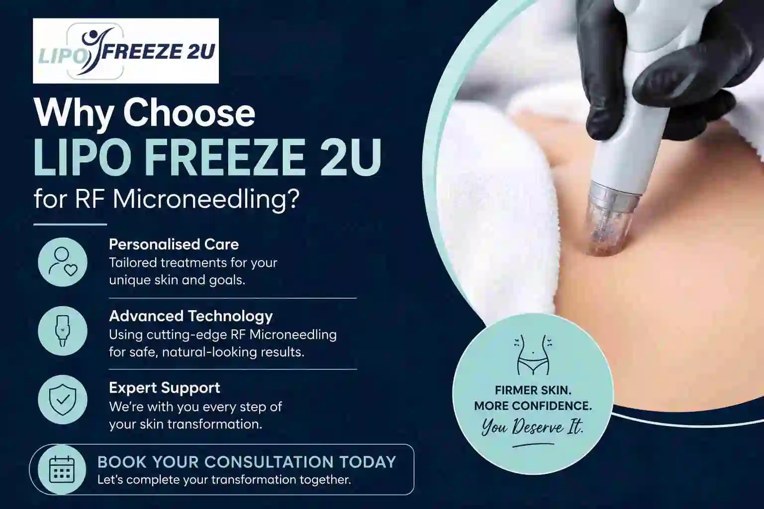 Why Choose LIPO FREEZE 2U for RF Microneedling Kingston upon Thames?